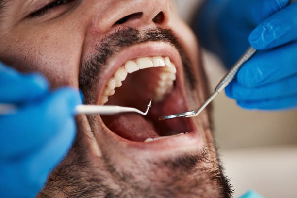 Best Cosmetic Emergency Dentistry in Quinebaug, CT