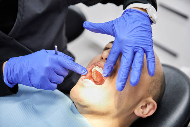Best Emergency Tooth Extraction in Quinebaug, CT