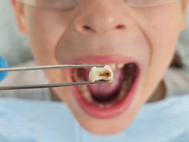 Best Emergency TMJ Treatment in Quinebaug, CT
